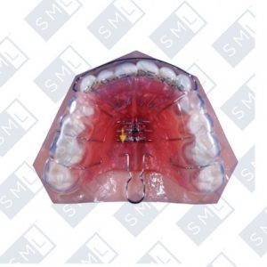 Dentist_Garland_TX_kid_dna-appliance